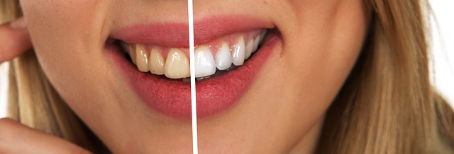 4 דרכים מומלצות לשמירה על שיניים לבנות
